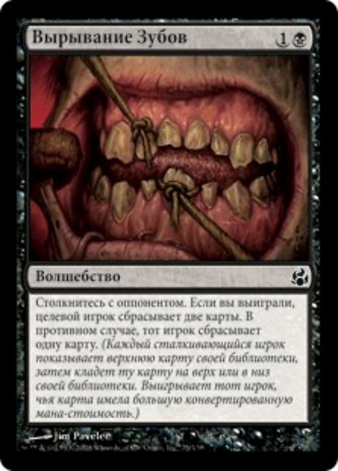 Вырывание Зубов